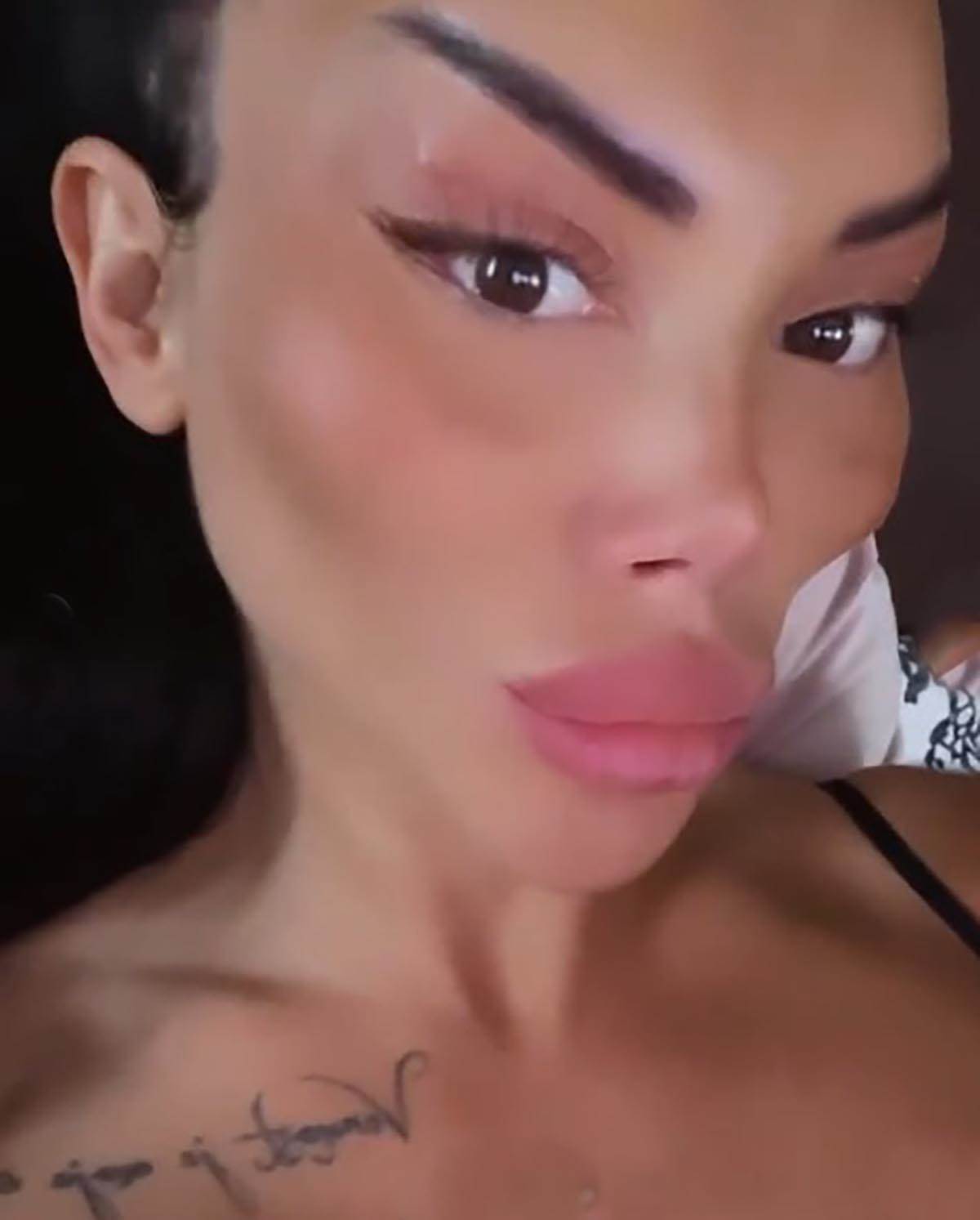 posle plastičnih operacija (9).jpg