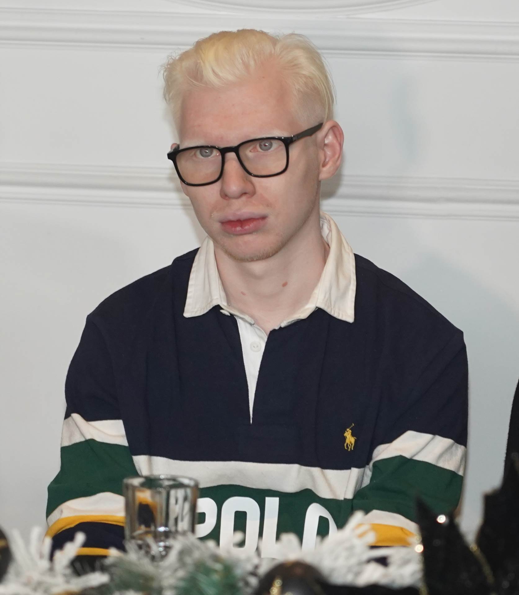 albino3.JPG