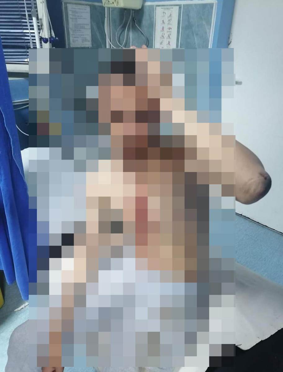 Pretučen mladić (3).jpg