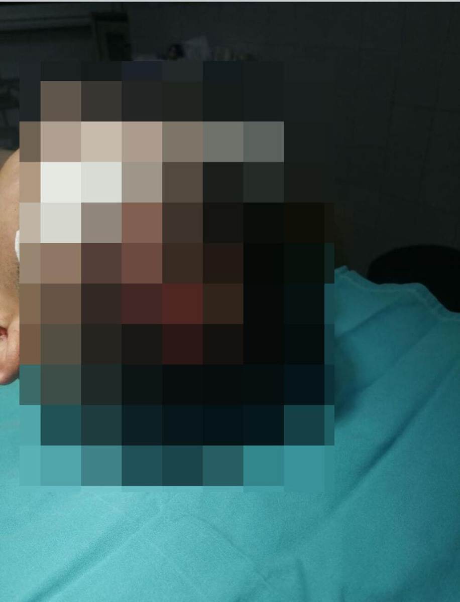 Pretučen mladić (4).jpg