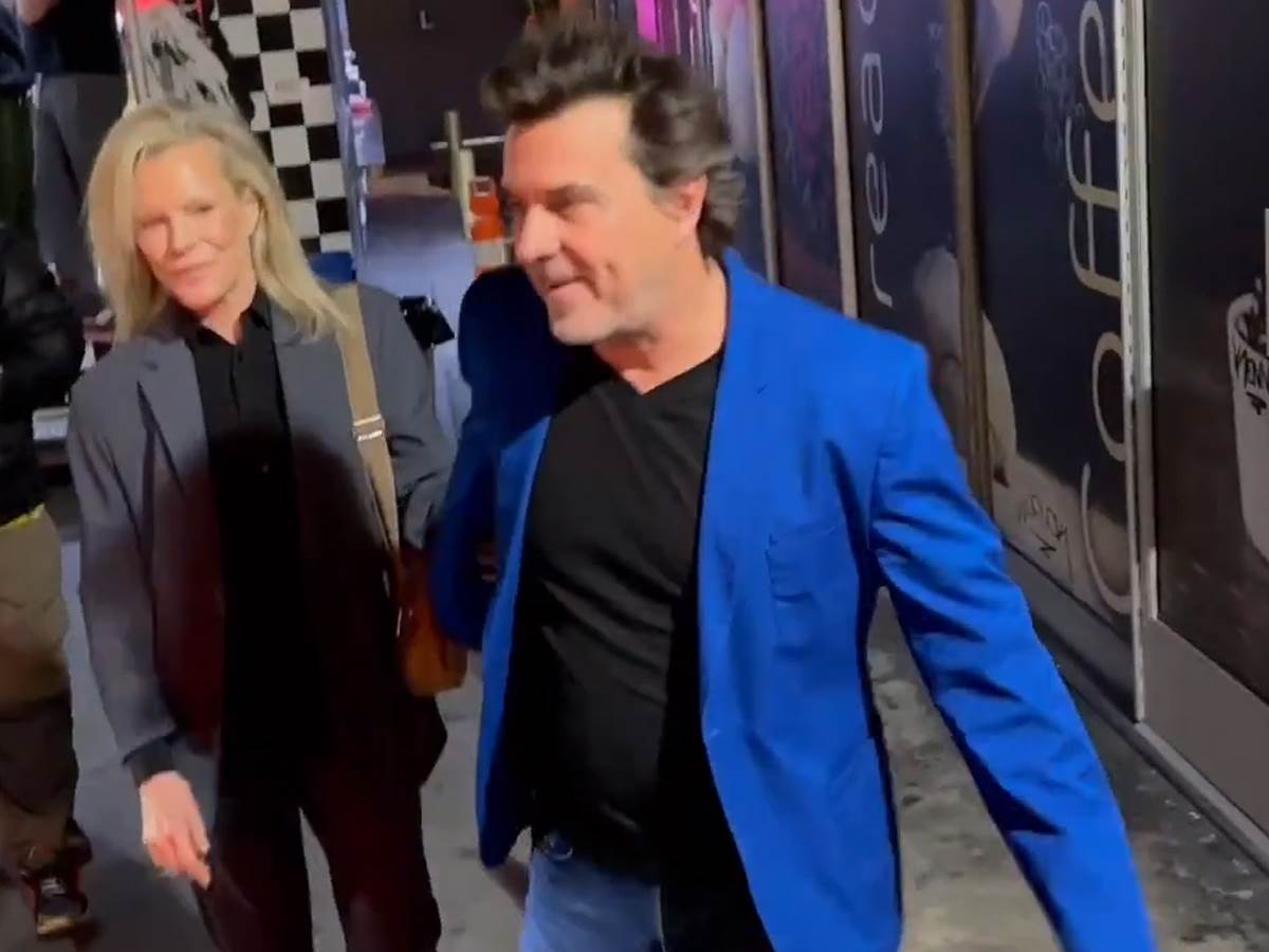 Kim Bejsinger pre i posle operacija