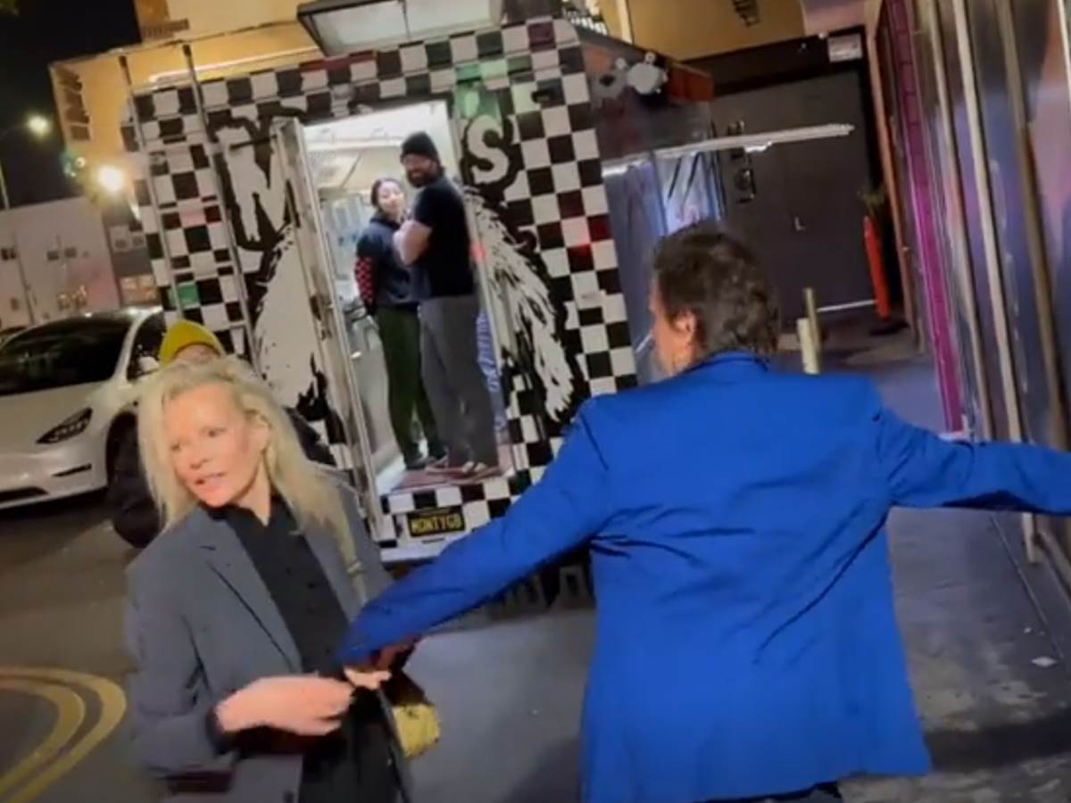 Kim Bejsinger pre i posle operacija