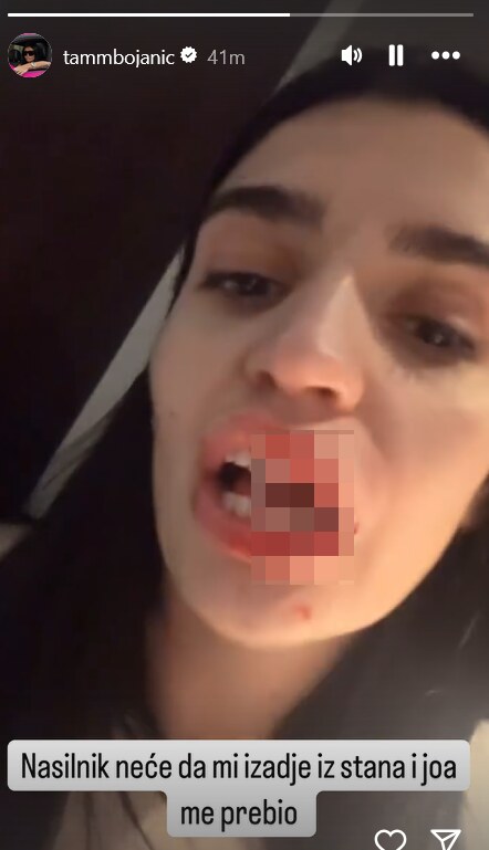 Tamara Bojanić sa krvavo usnom