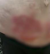 Rane na stomaku Leposave Bajković