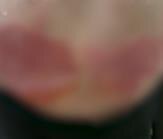 Rane na stomaku Leposave Bajković