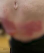 Rane na stomaku Leposave Bajković