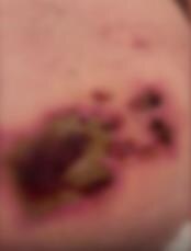 Rane na stomaku Leposave Bajković