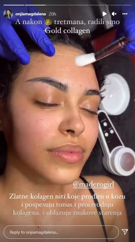 Onjia Magdalena pokazala je na sopstvenom primeru kako rade kolagen niti.