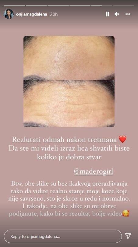 Onjia Magdalena objasnila je ceo postupak na svojim storijima.