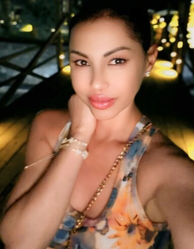 Tina Ivanović preterala sa botoksom