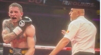 Srpskog boksera ugrizao Albanac