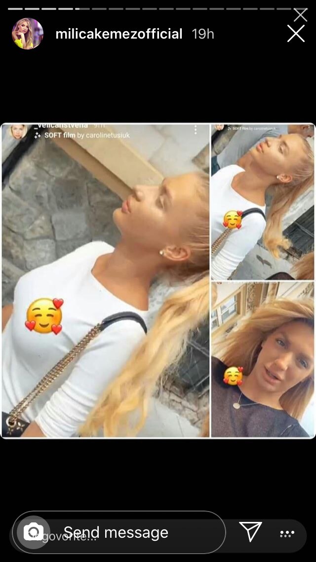 Milica Kemez nos nakon operacije izgled