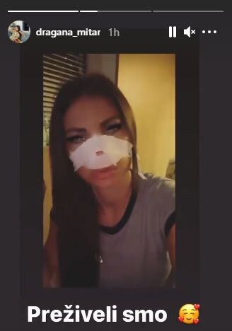 dragana mitar nova operacija plasticne operacije operisala nos