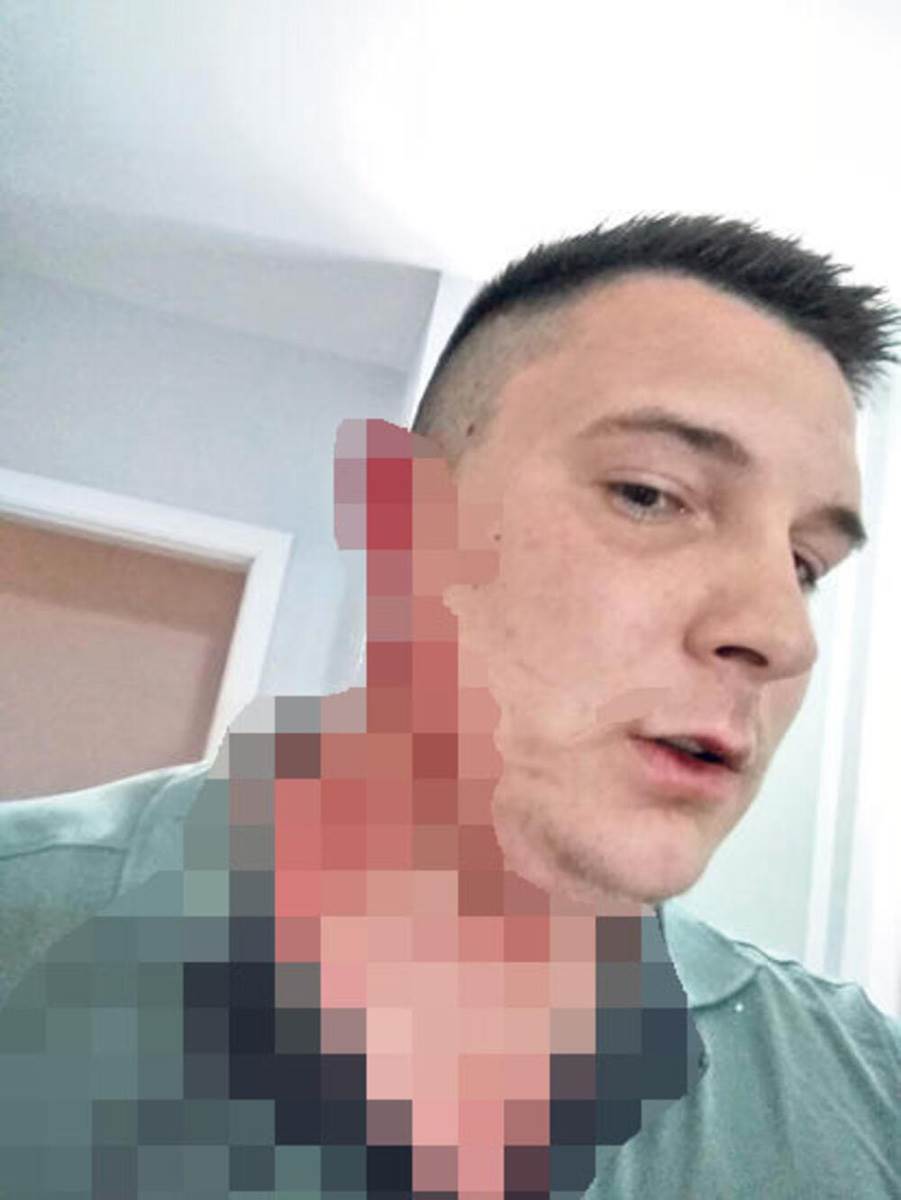 Gazda radniku odgrizao uvo  (4).jpg