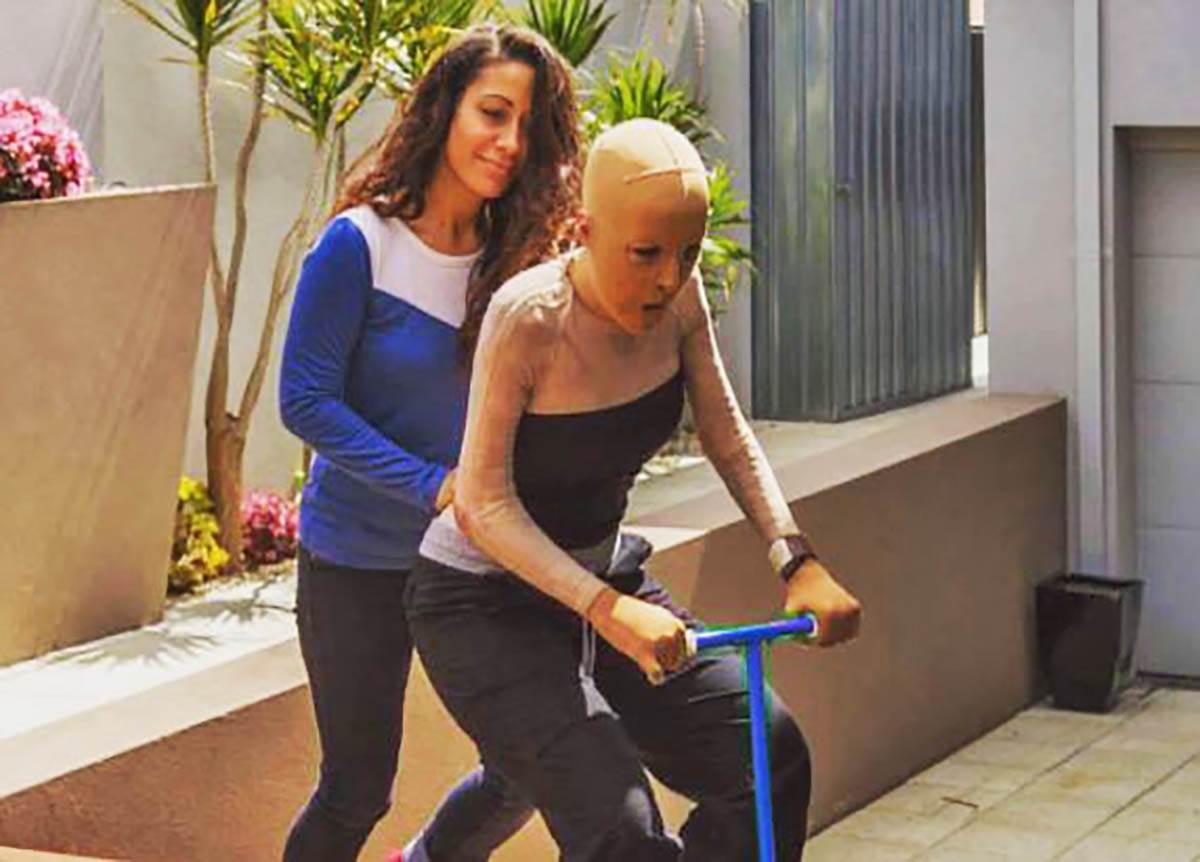 Kako danas izgleda Srpkinja koja je živa zapaljena