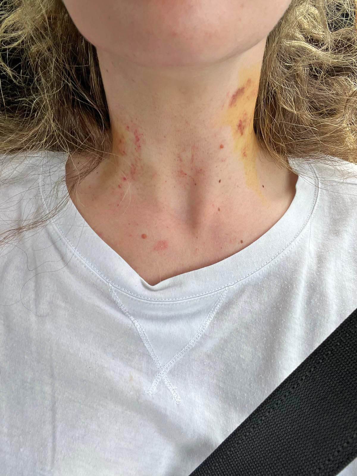 Nada Grujičić žrtva porodičnog nasilja ispovest Mondo