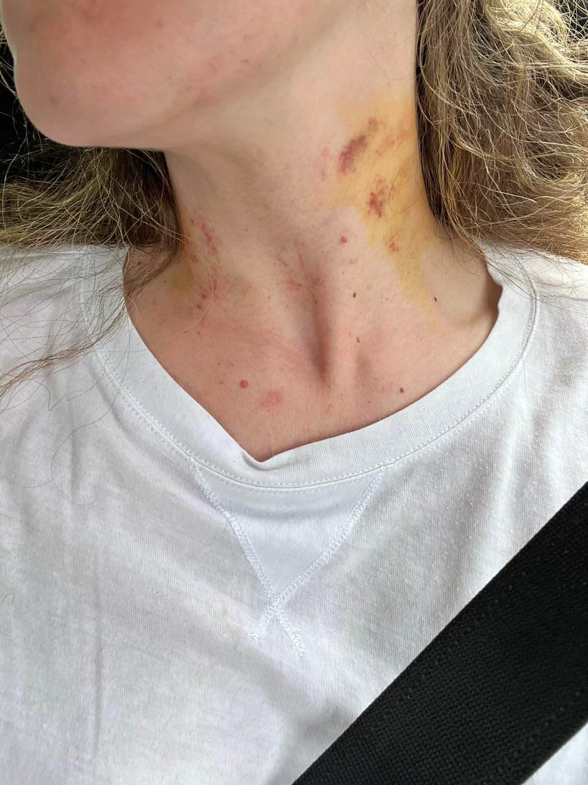 Nada Grujičić žrtva porodičnog nasilja ispovest Mondo