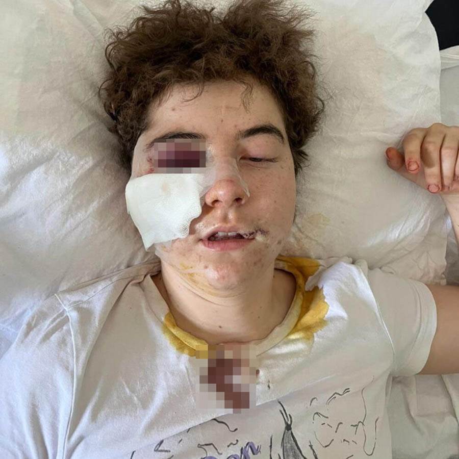 devojka   pretucena.jpg