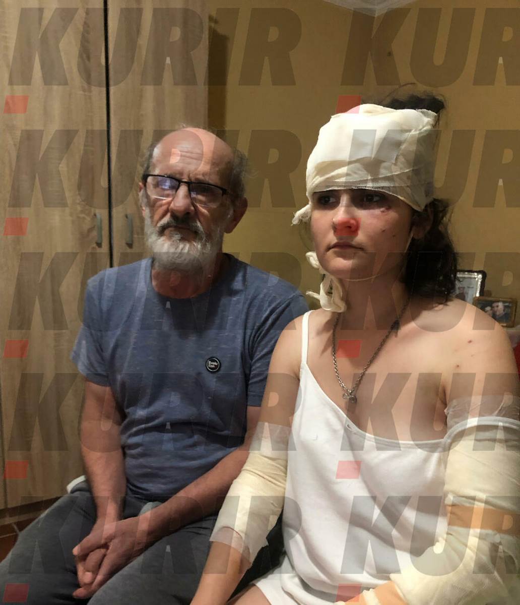 Kako izgleda MIljana koja je povređena u eksploziji u Smederevu