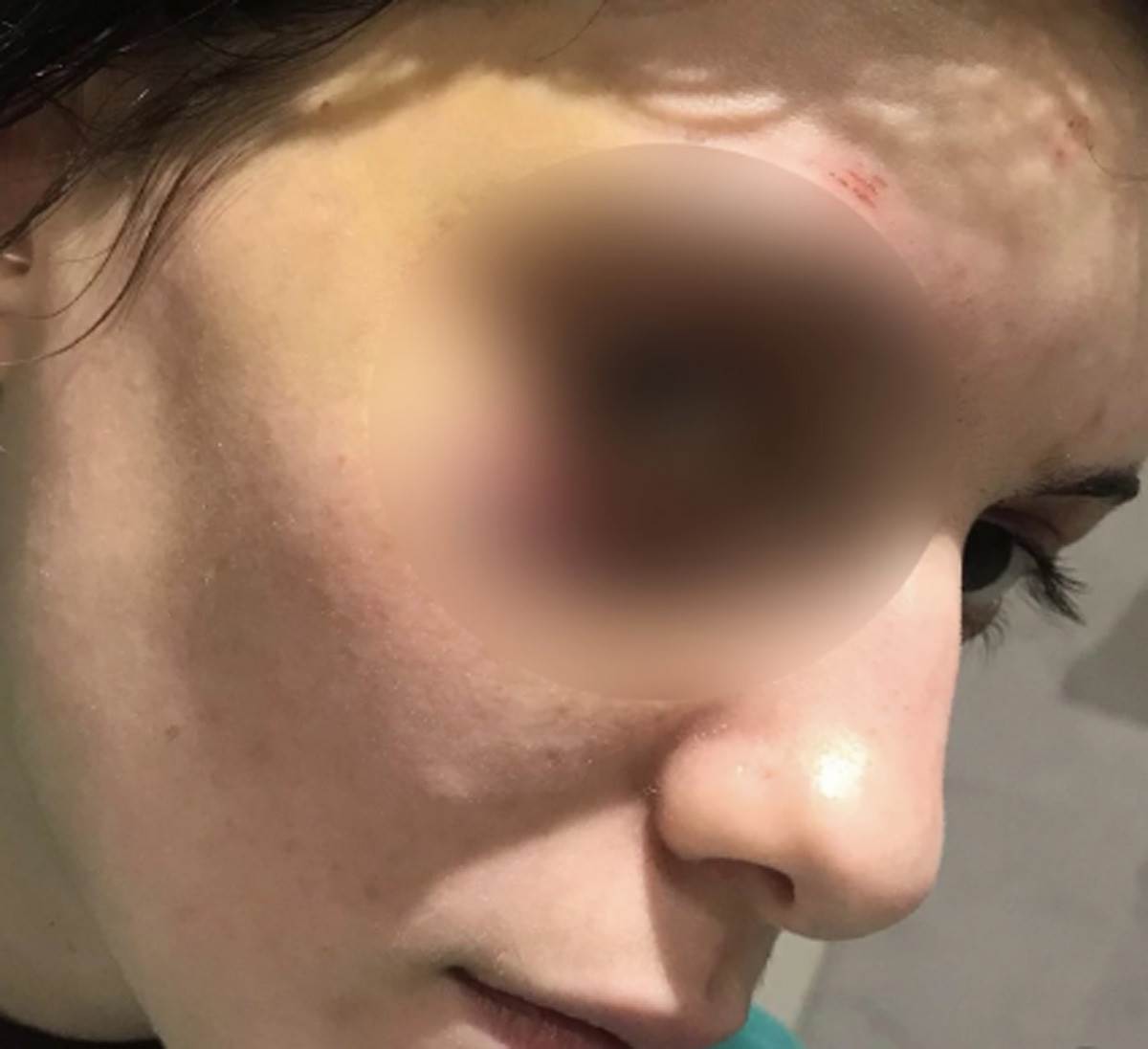 Pretučena devojka  (3).jpg