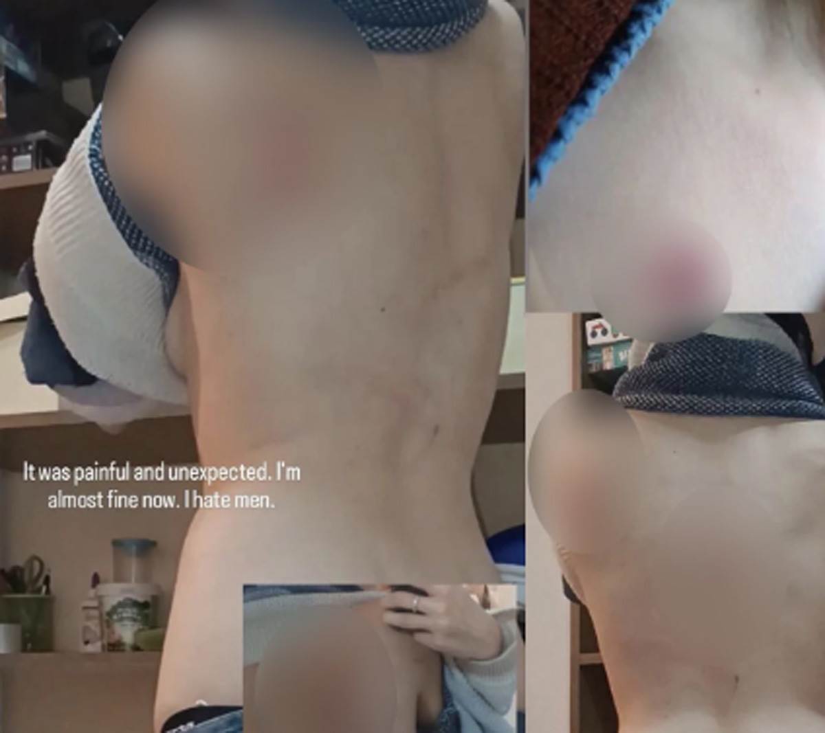 Pretučena devojka  (4).jpg