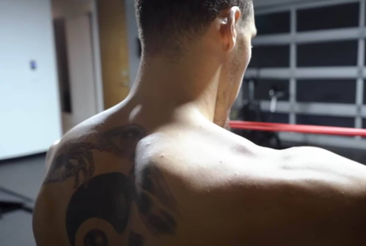 Rotvajler pas izujedao Erona Gordona