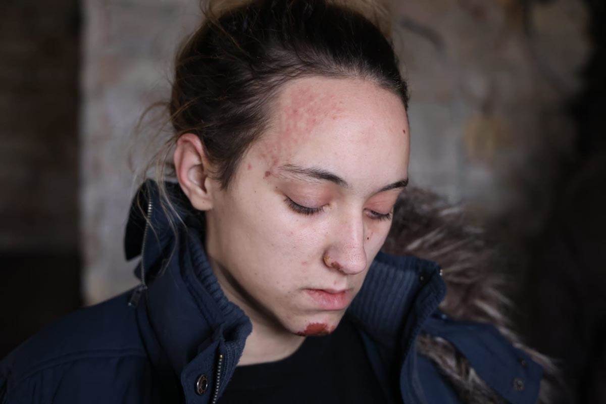 Detalji požara u Sopotu u kom je stradala beba