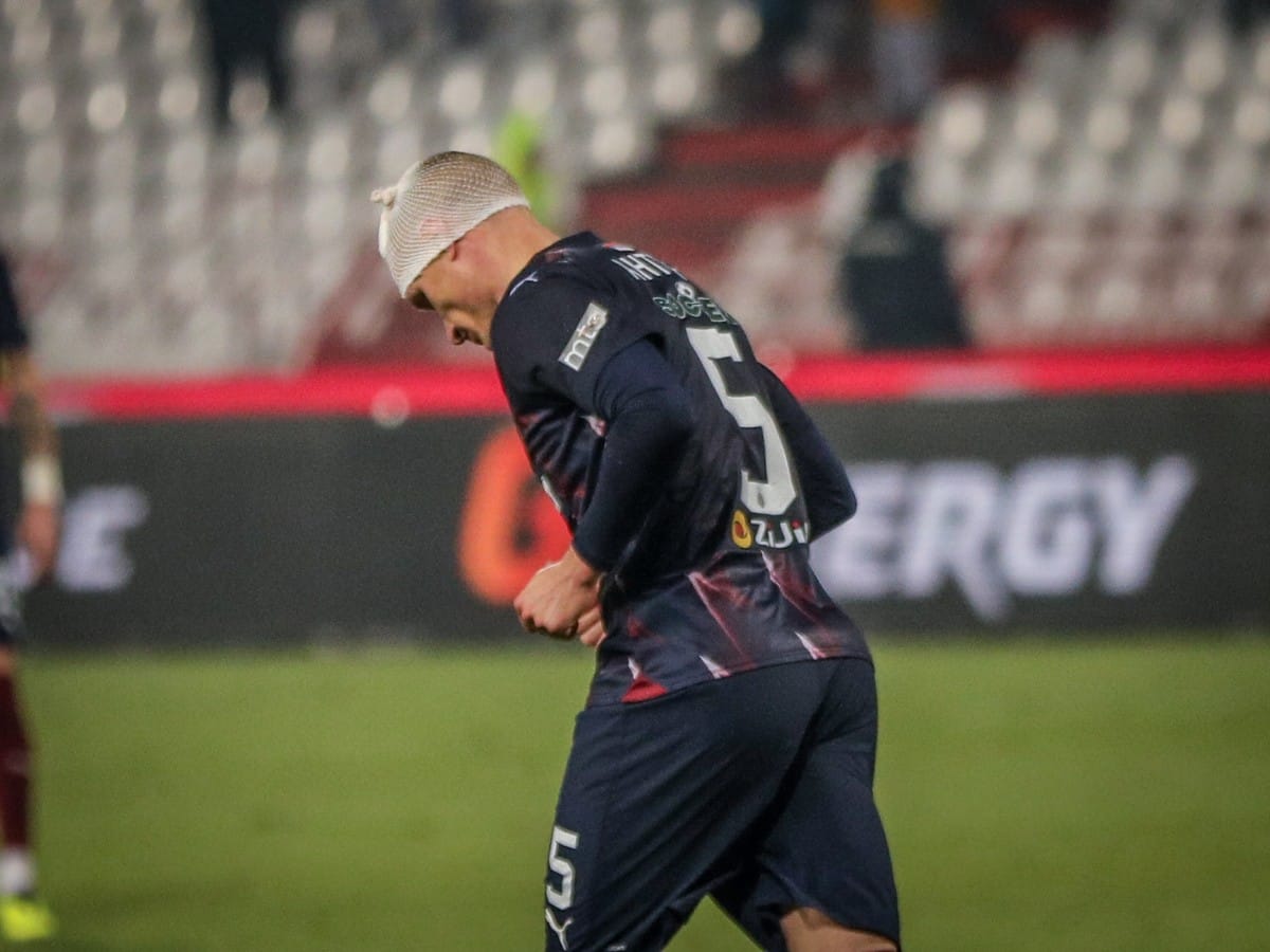 Antic povreda glave (5).jpg