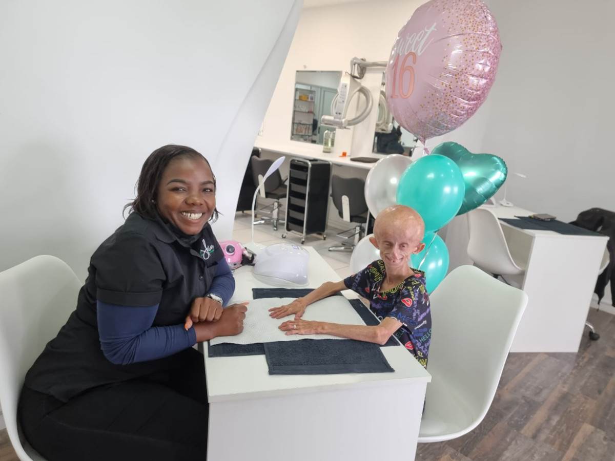 Preminula tiktokerka koja je bolovala od retkog genetskog poremećaja