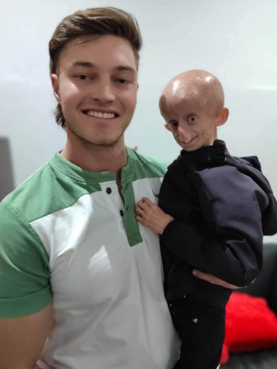 Preminula tiktokerka koja je bolovala od retkog genetskog poremećaja