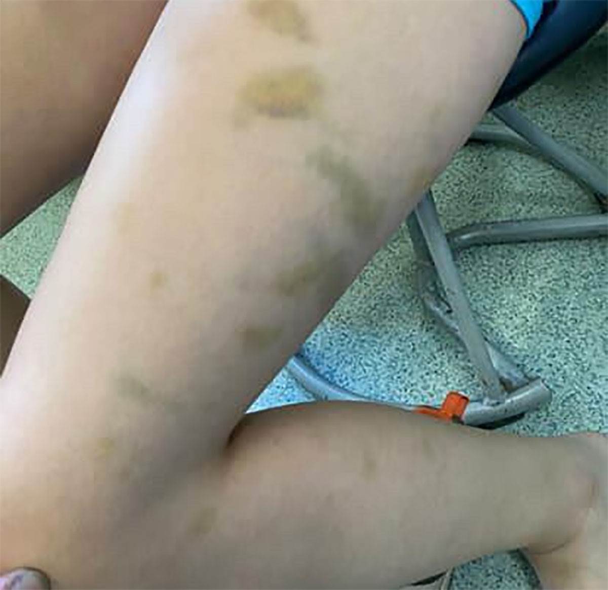 Vršnjak pretukao dečaka (1).jpg