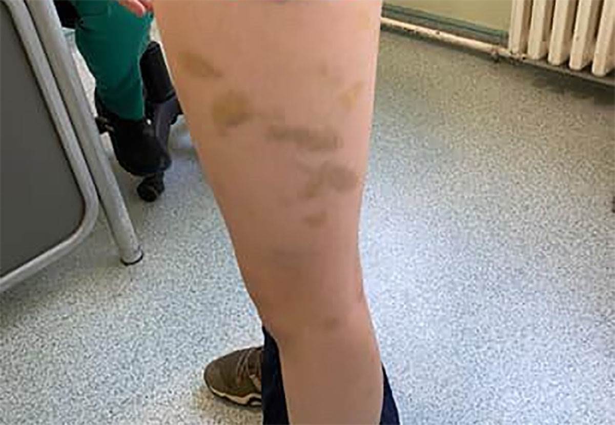 Vršnjak pretukao dečaka (2).jpg