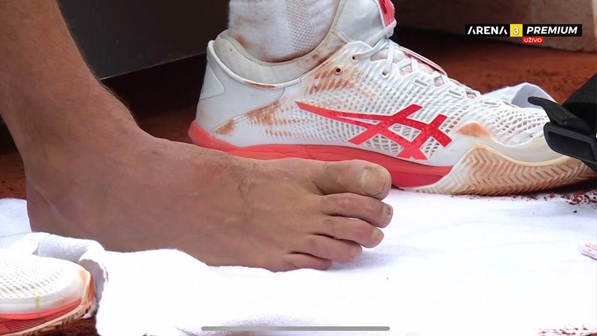 Novak Ðoković tražio lekarsku pomoć (2).jpg