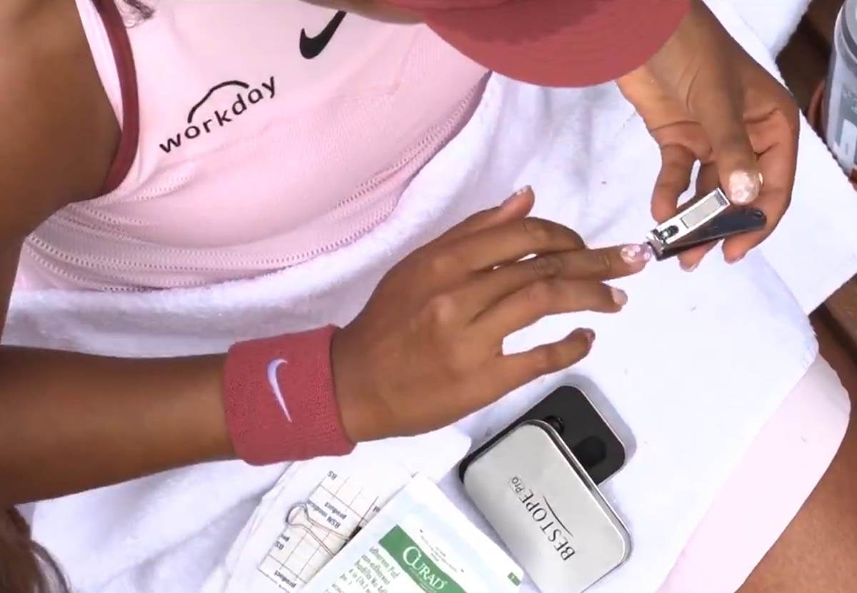Naomi Osaka sekla nokte tokom meča na Rolan Garosu