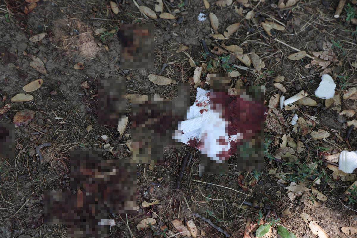 napad na tinejdžera (5).jpg