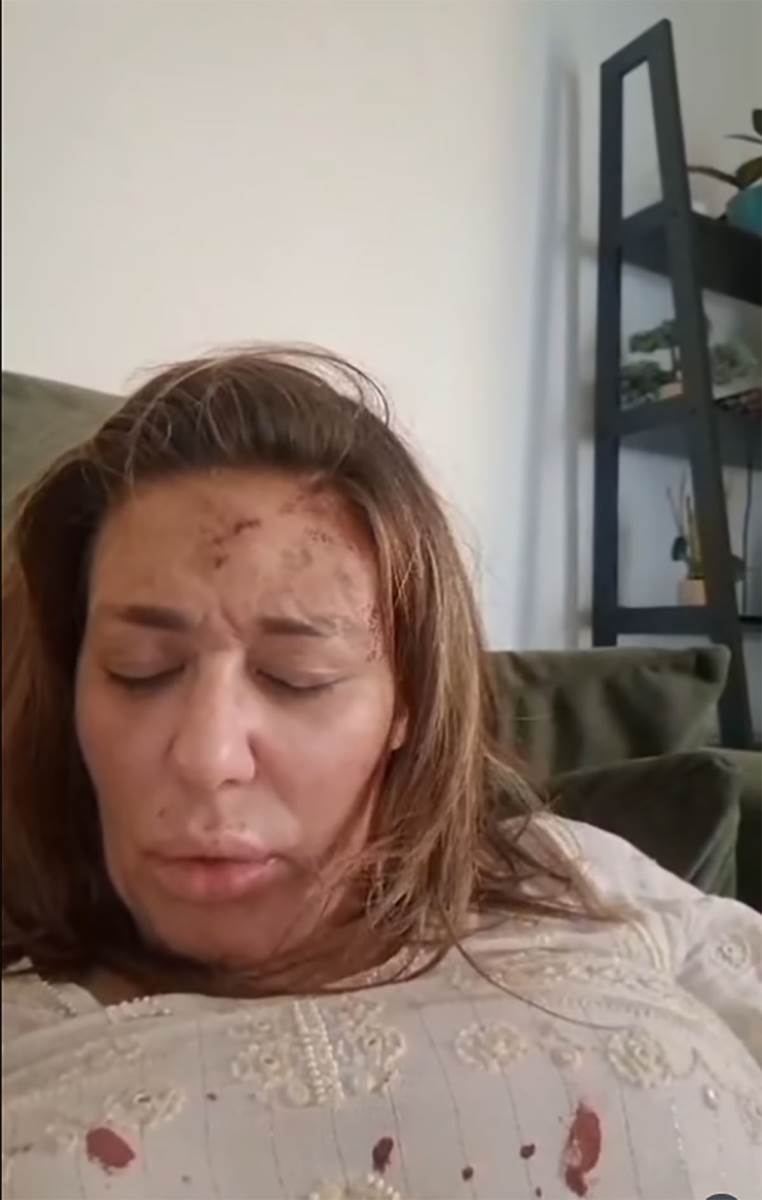 Ana Nikolić pretučena (4).jpg