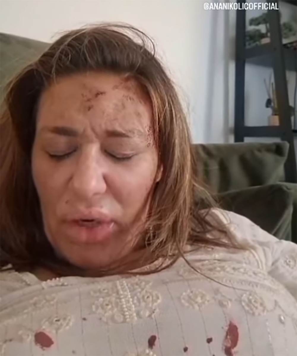 Ana Nikolić pretučena (6).jpg