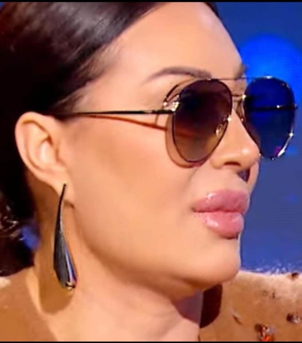 Ceca operisala nos? 4.jpg