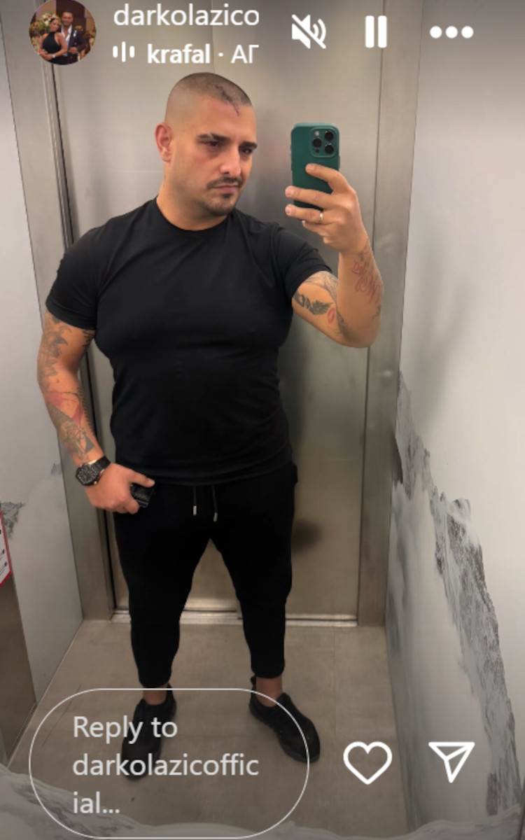 Darko Lazić priznao šta je imao sa Miljanom Kulić: Godinama ga uhodila, sada sve javno izneo