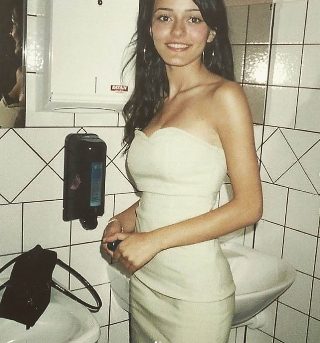 "Rezali su mi vilične kosti": Bivša zadrugarka otkrila stravične detalje borbe sa teškom bolešću