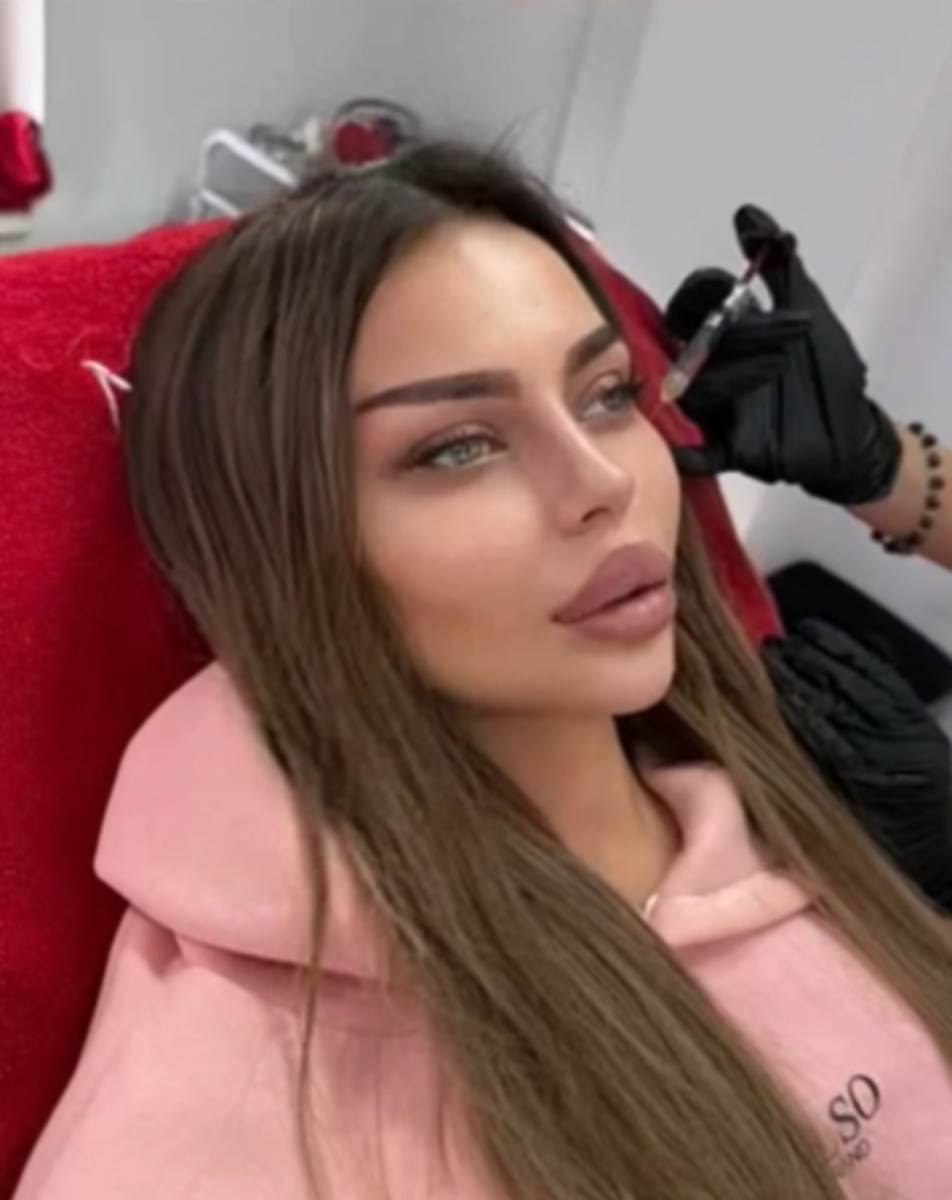 Sve plastične operacije Sofije Janićijević