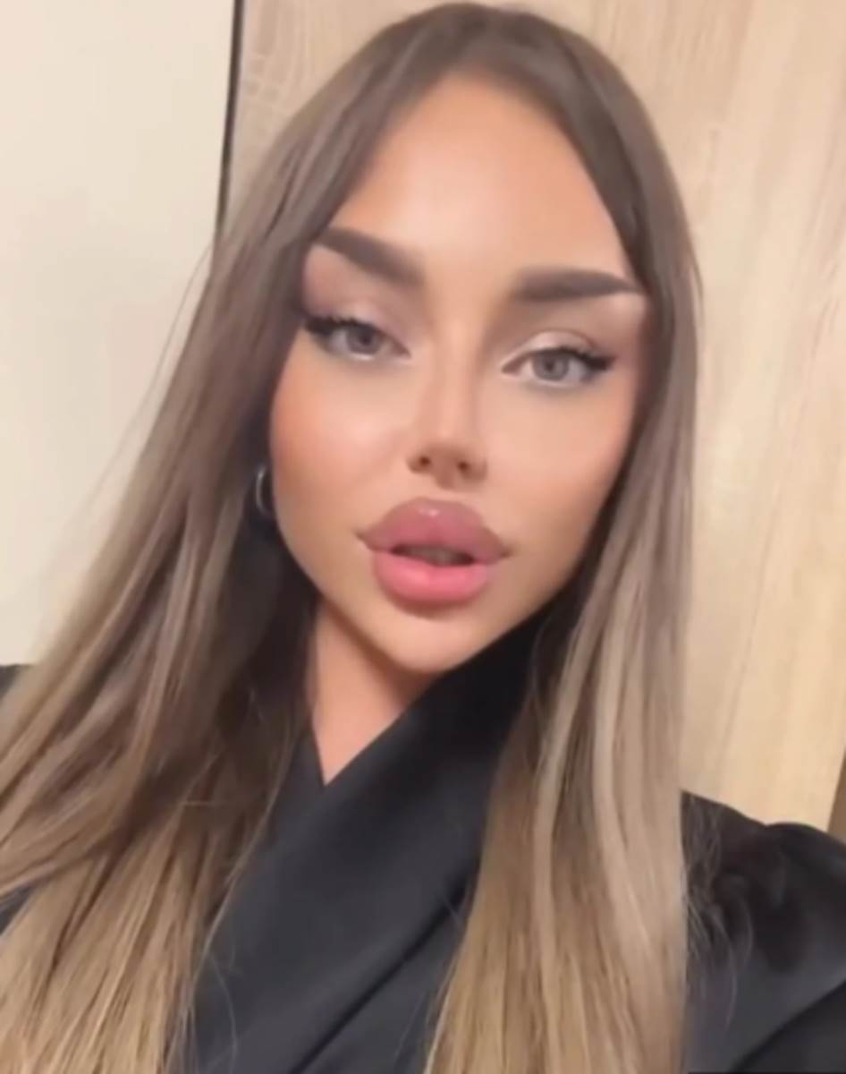 Sve plastične operacije Sofije Janićijević