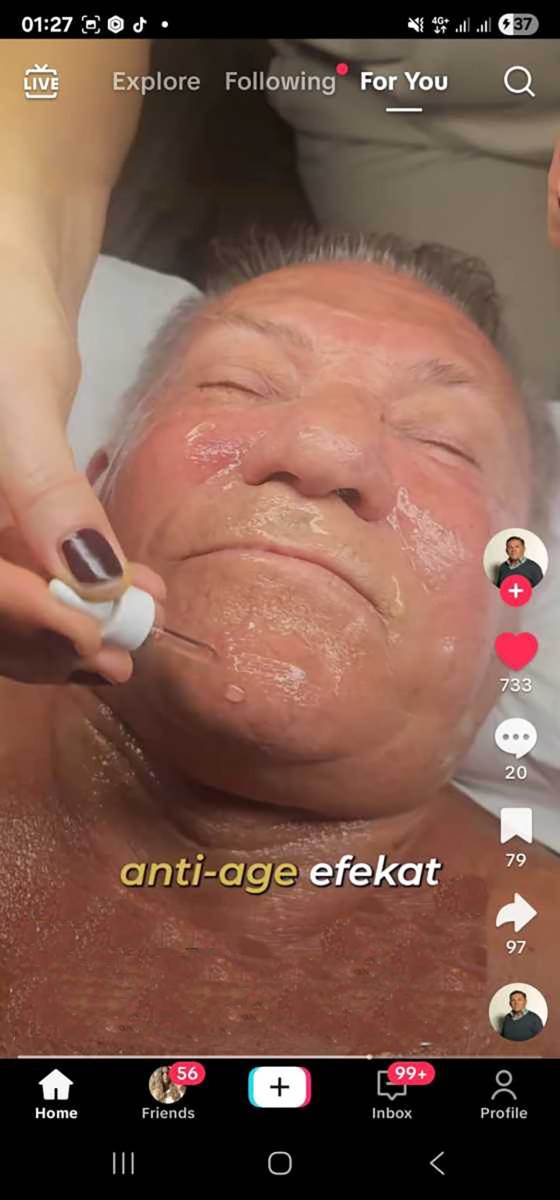 Miloš Bojanić podmlađivanje (1).jpg