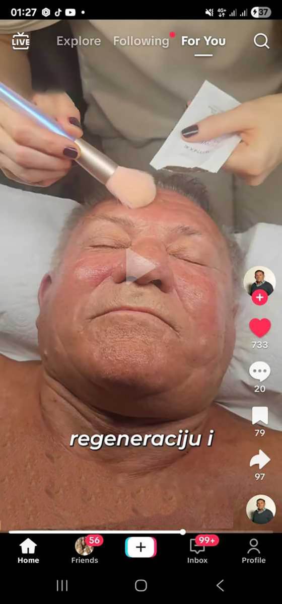 Miloš Bojanić podmlađivanje (3).jpg