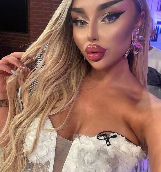 Sve plastične operacije Sofije Janićijević