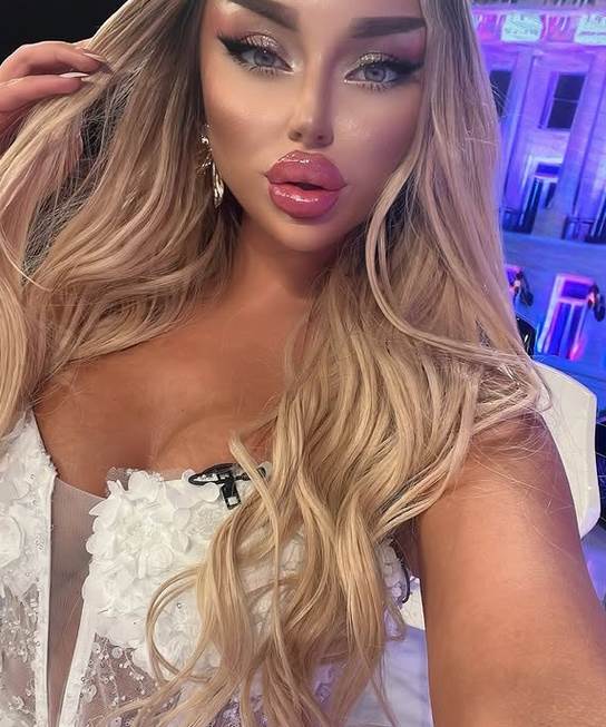 Sve plastične operacije Sofije Janićijević