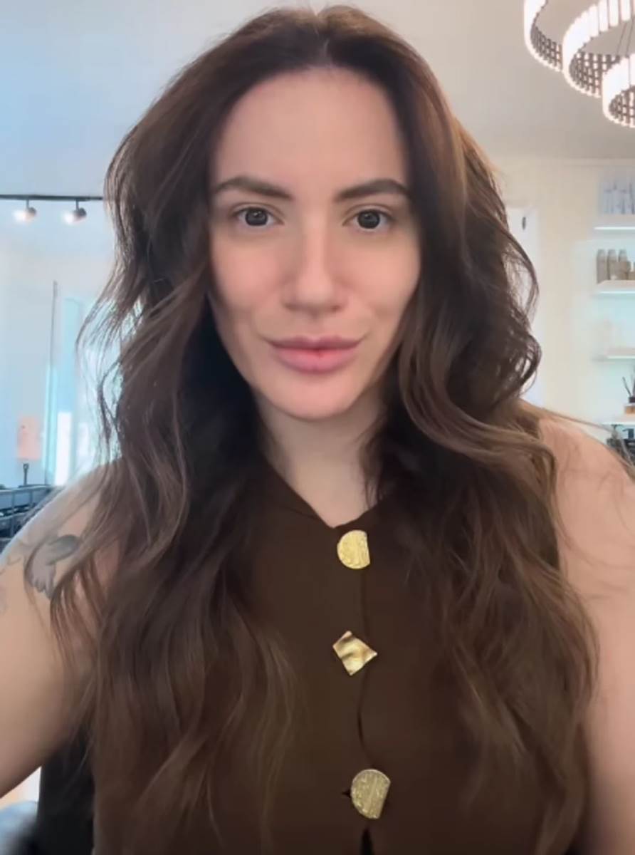 Kristina Spalević više ne izgleda isto: Šok transformacija nakon 5 operacija (Foto)