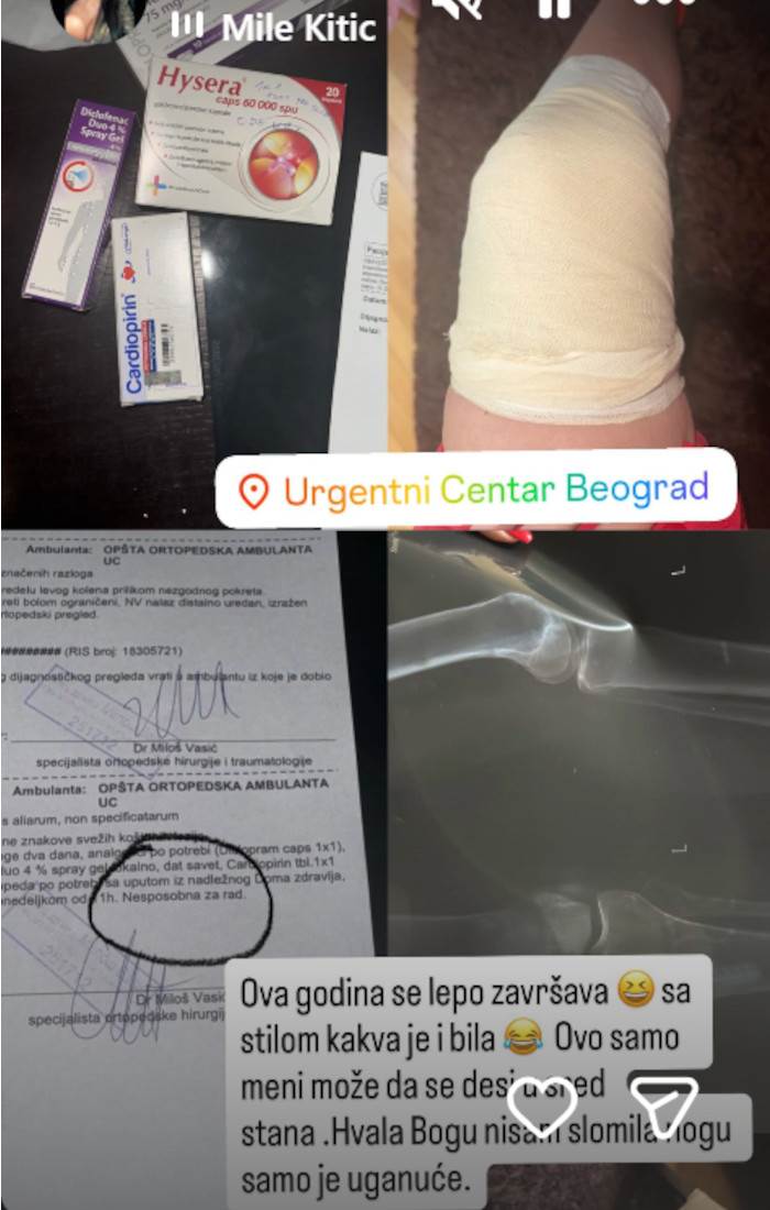 Mimi Oro povreda noge