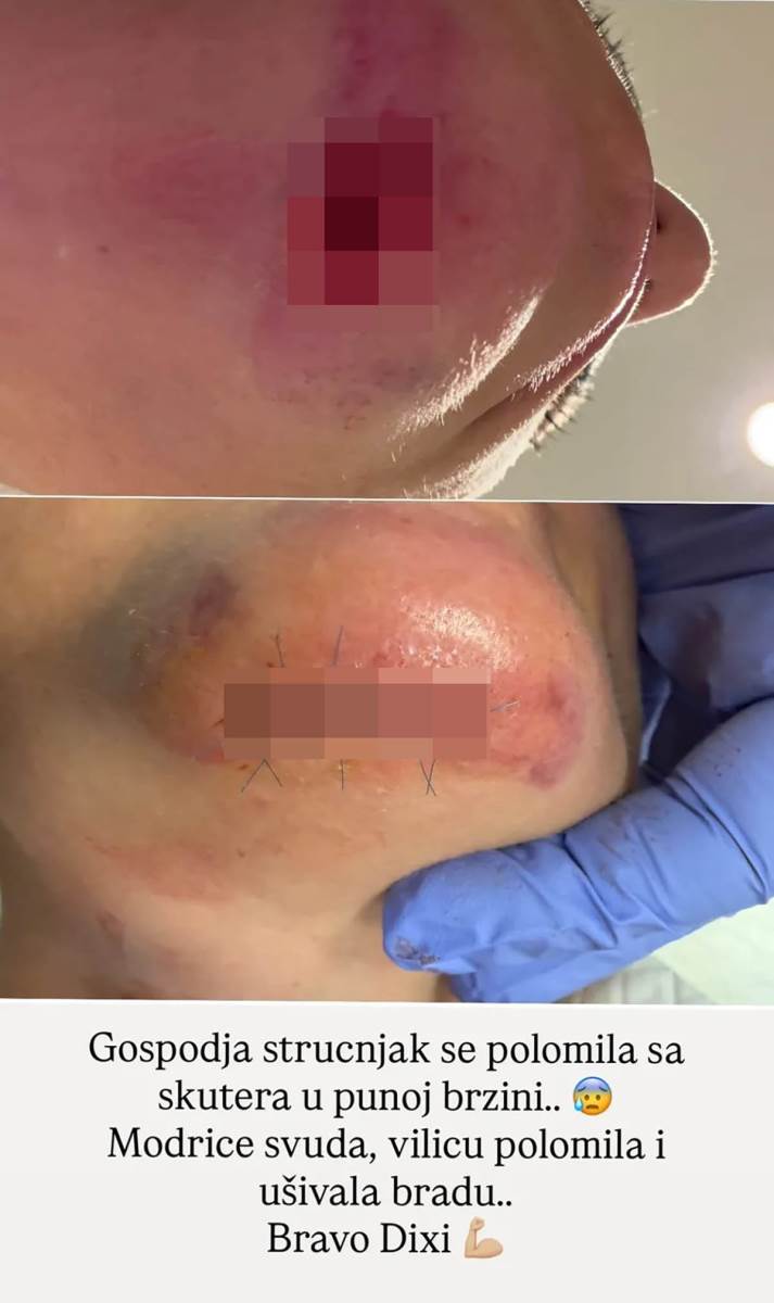 Dijana Dilajn nakon nezgode (1).jpg