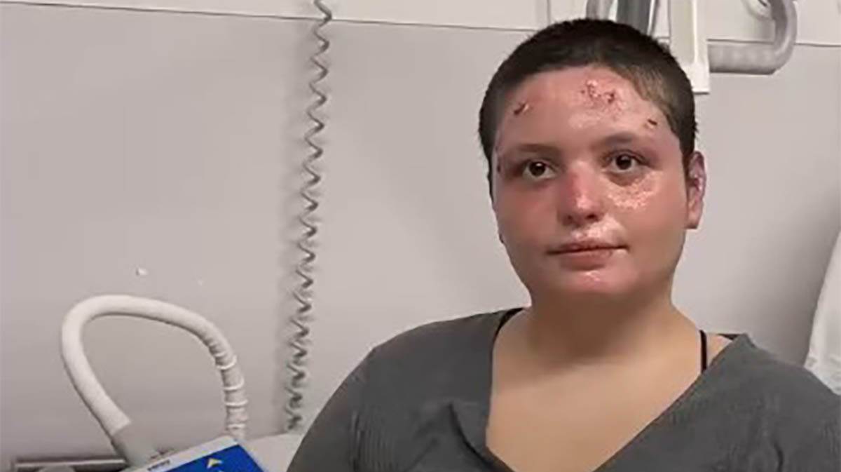 Preživela žrtva požara u Švajcarskoj (4).jpg